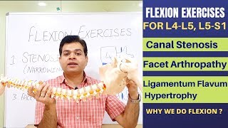 Flexion Exercises For Lumbar Canal Stenosis Facet Joint Arthropathy Ligamentum Flavum Hypertrophy [upl. by Troc363]