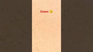 Semen motality under microscope 🔬viralvideoshortvideo [upl. by Ameehs]