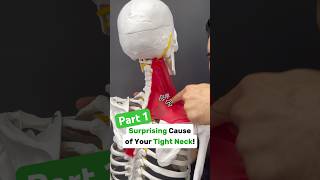 Part 12 Is your neck tight with shoulder blade or arm pain Try this neckpain shoulderpain tmj [upl. by Ashbaugh]