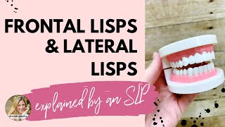 FRONTAL LISP VS LATERAL LISP explained by an SLP [upl. by Lorrin]