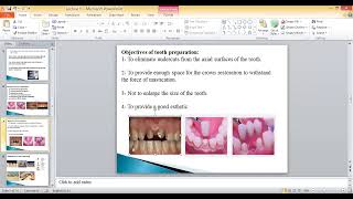 CampB Lec 1 An introduction to fixed prosthodontics [upl. by Bree]