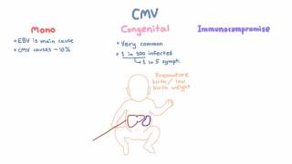 CMV Clinical Syndromes  Mono Congenital Infection Immunocompromised Hosts [upl. by Algernon94]