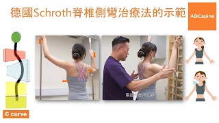 物理治療師  鄭進成 Aldous 示範德國Schroth脊椎側彎治療法單胸彎 [upl. by Lillith]