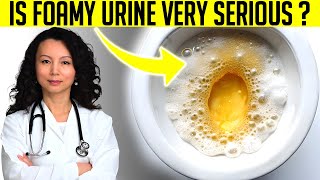 Top 5 Reasons Of Foamy or Bubbly Urine One Is Kidney Disease [upl. by Lucilia]