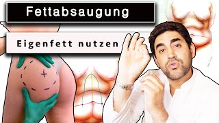 Unglaublich Fettabsaugung und das Fett nutzen  Lipofilling  Dr Alawi [upl. by Ellita]