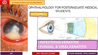 Infectious Keratitis LECTURE 3 Fungal amp Viral KERATITIS [upl. by Haddad881]