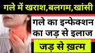 गले मे खिच खिच  गले में खराश  इन्फेक्शन का पक्का इलाज ज़रूर देखें । No More Sore Throat Now [upl. by Romalda]