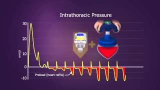 ResQCPR System [upl. by Nakhsa]