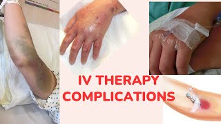 IV therapy Complications 💉🩸nclexrn nclexreview nursing education nursingexam nclex viral [upl. by Eittod]