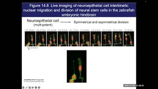 Neuroepithelial cell [upl. by Takken]