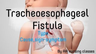 Tracheoesophageal Fistula TEF cause signsymptom childhealthnursing bscnursing 5thsem24 [upl. by Huxham493]