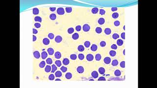 Rickettsial diseasesAnaplasmosis and Q fever ppt [upl. by Hausner]