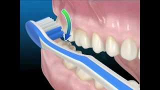 Tecniche di igiene orale Uso corretto dello spazzolino da denti [upl. by Edveh600]