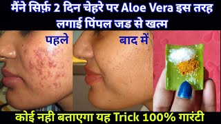 मैंने सिर्फ 2 दिन चेहरे पर यह लगाया सारे Pimples जड़ से खतम चेहरा गोरा हो गया How to Remove Pimples [upl. by Inail373]