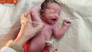 Breech delivery of beautiful newborn baby viral baby [upl. by Piers]