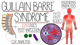 Guillain Barre Syndrome Explained Clearly Including Subtypes [upl. by Ylicec]