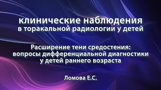 Ломова ЕС – Расширение тени средостения дифференциальная диагностика у детей раннего возраста [upl. by Giles393]