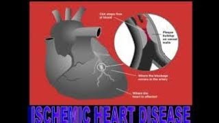 Ischemic Heart DiseaseDefinition of ischemic heart disease  Causes of ischemic heart disease✨ [upl. by Hoisch472]