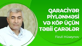 Qaraciyər piylənməsi və köp üçün təbii çarələr  Qaraciyər piylənməsinin müalicəsi  Fizuli Hüseynov [upl. by Marmion82]