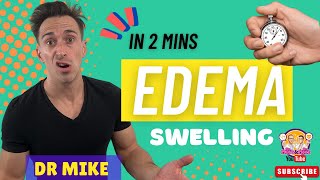 Edema Oedema  In 2 minutes [upl. by Ley]