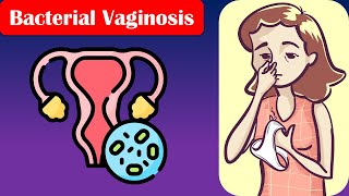 Bacterial Vaginosis  Causes Risk Factors Signs amp Symptoms Diagnosis And Treatment [upl. by Herson]