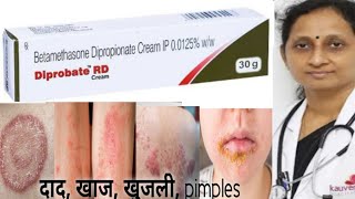 Diprobate rd cream  Betamethasone Dipropionate Cream  खाज खुजली और फंगल इन्फेक्शन से देगा [upl. by Anihpesoj]