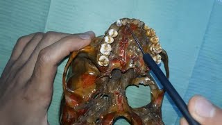 skull foramina identification amp structures passing through practical عربي [upl. by Yerbua]