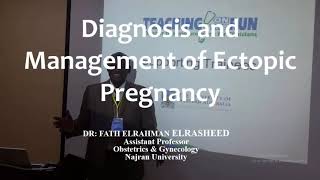 RCOG Guidelines Diagnosis and Managment of Ectopic Pregnancy [upl. by Avi]