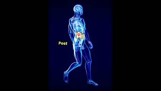 Prostatectomy indications and procedure medicine pharmacist nursing dental [upl. by Janella]