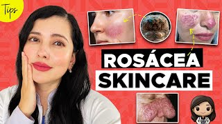 ¿TIENES ROSÁCEA ASÍ DEBE SER TU SKINCARE 👩🏻‍⚕️👌🏻🤝🏻 [upl. by Licko]