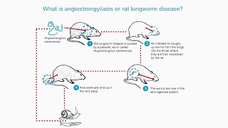 What is Rat Lungworm Angiostrongylus Disease [upl. by Klecka134]