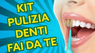 Kit Rimozione Tartaro Pulizia dei Denti Professionale con luce  Recensione ITA [upl. by Schellens186]