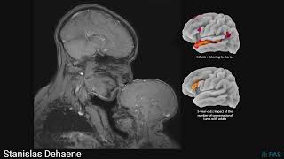 Stanislas Dehaene – Seeing the mind 35 years of progress in brain imaging [upl. by Atiuqer]