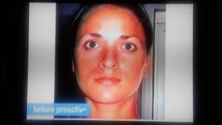 Proactiv Solution Commercial 2007 2 [upl. by Ahsikin488]