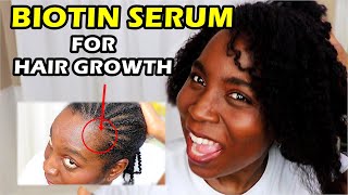 Using Biotin Serum on Scalp for Rapid Hair Growth and Thicken Hair  DiscoveringNatural [upl. by Latnahc]