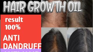 hair growth oil hair growth rosemary oil for hair growth hair growth tips wild growth hair oil [upl. by Jasmine]