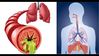 How to Remove Mucus From Lungs Naturally [upl. by Allin]