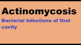 Actinomycosis  Bacterial infections of the oral cavity [upl. by Anaed379]