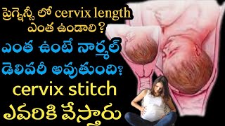 what is the normal cervix length during pregnancy  cervix length during pregnancy chart in telugu [upl. by Annahsat118]