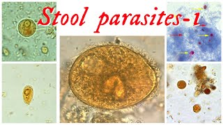 Stool parasites part 1  Concentration techniques  Amoeba Giardia  B Coli  Cryptosporidium [upl. by Albur]