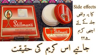 Stillmans freckle cream  Side effects  Honest Review on Stillmans freckle cream [upl. by Grobe]