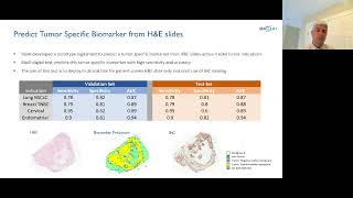 Alan JerusalmiMultimodal AI for Translational Research amp Precision Medicine [upl. by Alisia]