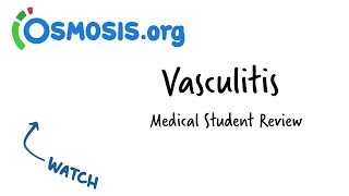 Vasculitis  Clinical Presentation [upl. by Yerrok]