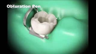 Root canal treatment and Cap [upl. by Anerehs]