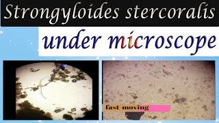 Strongyloides stercoralis under microscope in Stool sample [upl. by Kavita]