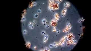 What is the difference between Agglutination and Coagulation [upl. by Emmuela523]