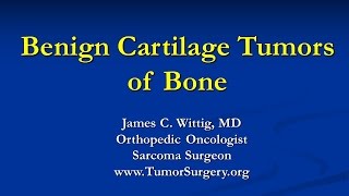 Orthopedic Oncology Course  Benign Cartilage Tumors Osteochondroma Chondroblastoma  Lecture 5 [upl. by Ahsitel]