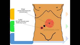 1 Dolor abdominal Clasificación Fisiopatología  Etiologías [upl. by Alledi447]