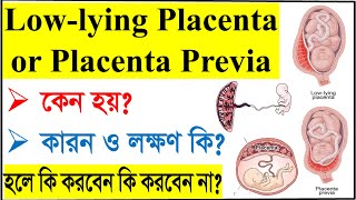 Low lying placenta or Placenta previa কি কেন হয় লক্ষণ কি হলে কি করবেন এতে নরমাল ডেলিভারি হয় [upl. by Bette]