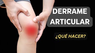 Artrosis de Rodilla  Desgaste articular Que es Tratamiento [upl. by Ahsilrac]